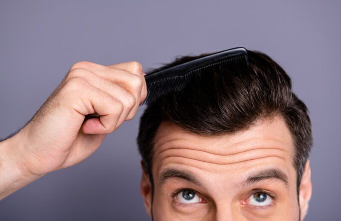 התקרחות גברית: כיצד נמנע נשירת שיער אצל גברים? - אלטמן בריאות
